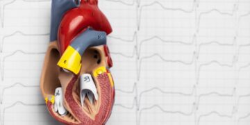 Ischemic Heart Disease (Coronary Heart Disease)