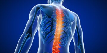 Spinal Muscular Atrophy (SMA): Causes, Symptoms & Treatment Options